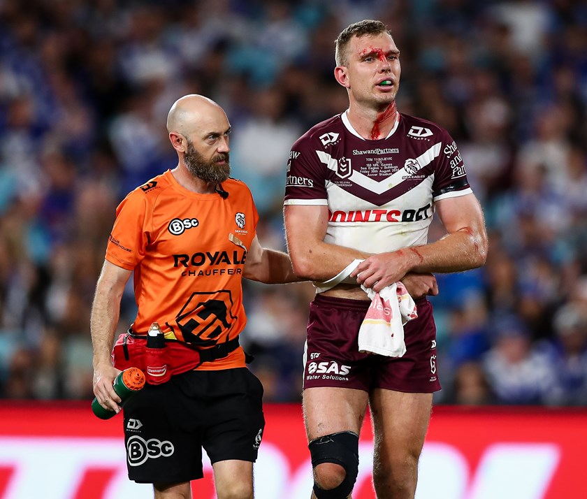 A bloodied Tom Trbojevic leaves the field with a shoulder injury